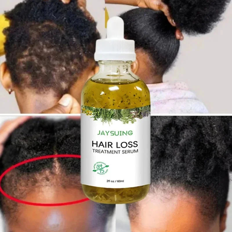 Rosemary Hair Growth Serum Anti Hair Loss